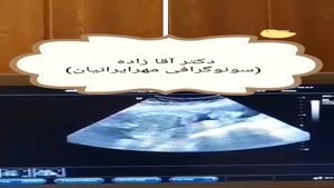 سونوگرافی از جنین بیست و چهار هفته