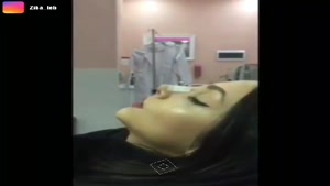 چسب زدن به بینی بعد از جراحی بینی در مشهد 09380000893