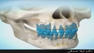 مراحل رشد و تکامل دندان