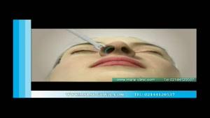جراحی بینی | فیلم جراحی بینی | کلینیک پوست و مو مارال | شماره 1