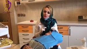 نمونه روکش زیبایی و لمینت دندان توسط دکتر ندا هادی