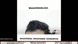اسپری موی تقویت موی آقایان | 09120132883 | اسپری پرپشت کننده