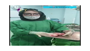 فیلم جراحی فیبروم رحم با حفظ رحم و تخمدان در دختر جوان