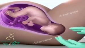 ساختار واژن و قرار گرفتن نوزاد برای زایمان طبیعی در آن