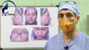 فیلم جراحی رینوپلاستی در بینی های گوشتی