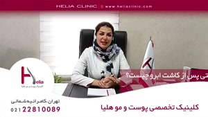بهترین دکتر تزریق ژل در تهران کیست؟ | کلینیک هلیا