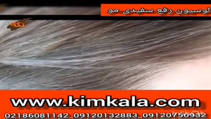 خرید محلول درمان سفیدی موی سر/09120132883