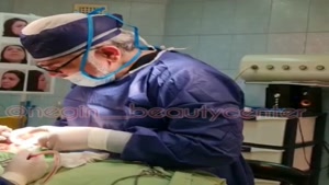 دکتر ملکان راد، فیلم جراحی بینی کامل ، گرگان ، 09119409301