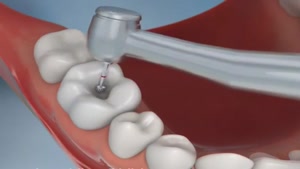 مواد آلژینات دندان پزشکی در سبحان دنتال