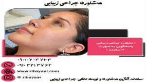 جراح بینی در شهر مشهد