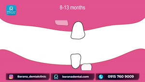 ترتیب رشد دندان های شیری