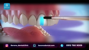 مراحل انجام ارتودنسی دندان