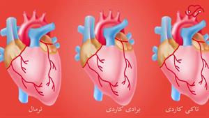 آیا ضربان قلب پایین خطرناک است؟