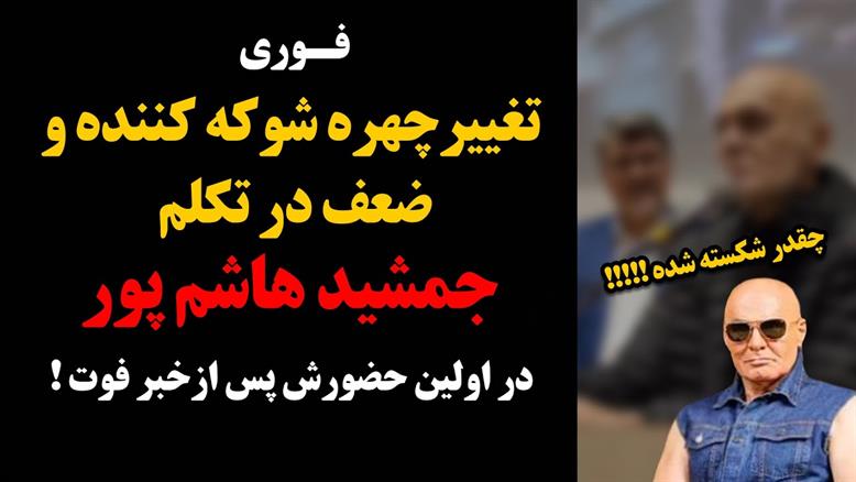 تغییر چهره شوکه کننده و ضعف در تکلم جمشید هاشم پور