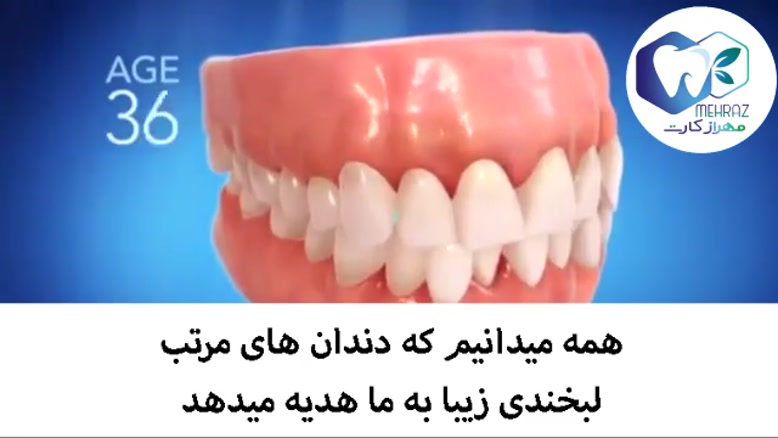 عوارض نامرتبی دندانها